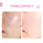 Hydraterende Anti-aging Moisturizer | 1+1 Gratis!
