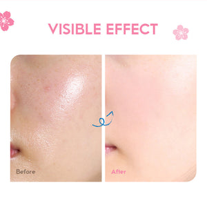 Hydraterende Anti-aging Moisturizer | 1+1 Gratis!