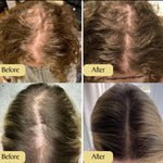 Vegan Haargroei Serum - Alleen Vandaag 1+1 gratis!