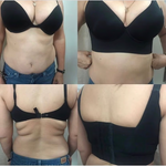 Chique Lift - Ondersteunende Shaper BH
