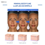Alra Renewal Serum - hydraterende Anti-Aging Serum