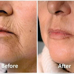 Collageen Anti-Veroudering Serum - Herstel je jeugdige straling!