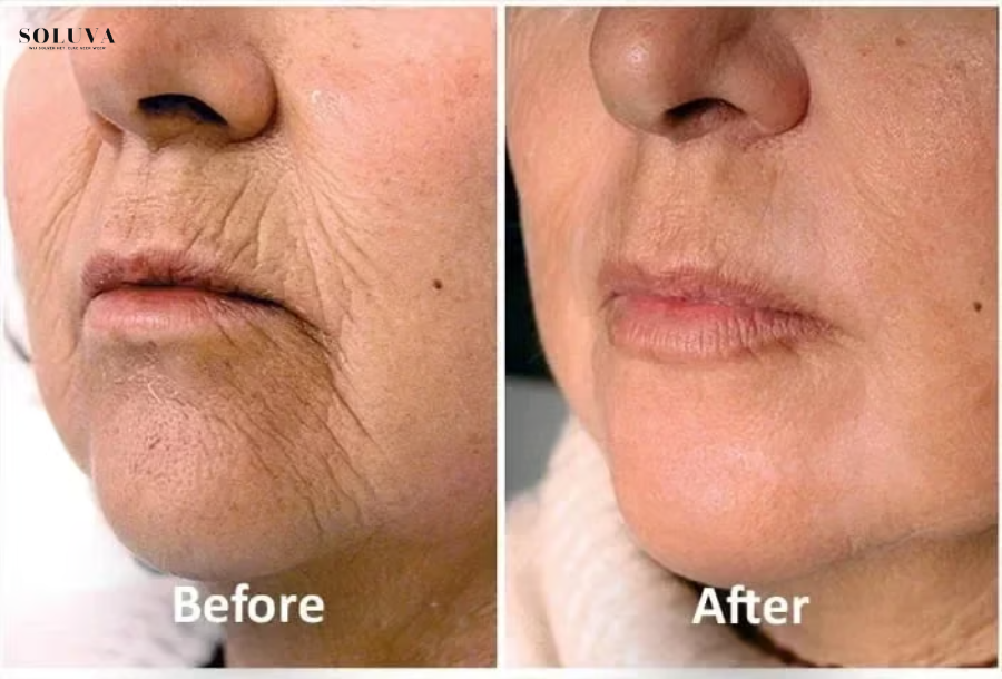 Collageen Anti-Veroudering Serum - Herstel je jeugdige straling!