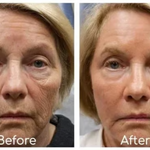 Collageen Anti-Veroudering Serum - Herstel je jeugdige straling!