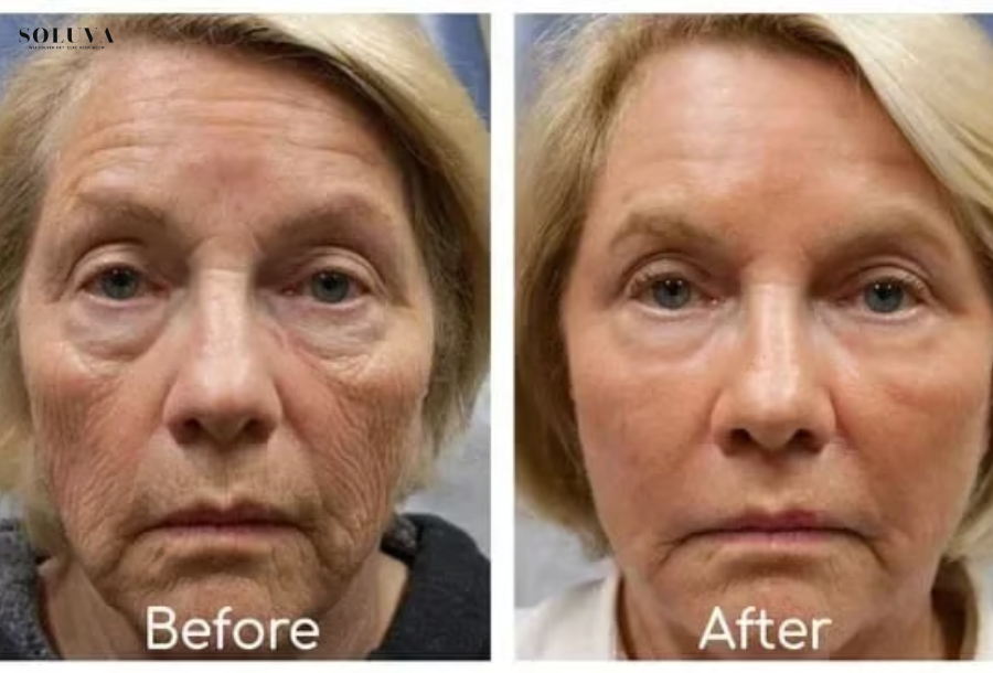 Collageen Anti-Veroudering Serum - Herstel je jeugdige straling!