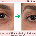 GlowLift - Oogverjongende Hersteltherapie