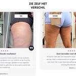 Anti-Cellulite Verstevigingsmassage