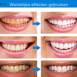 Teeth Essence - Ultra Sterke Tandenbleker - 1+2 Gratis!