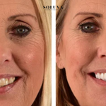 Teeth Essence - Ultra Sterke Tandenbleker - 1+2 Gratis!