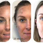 SkinShine - Huidverhelderende Gezichtsserum - 1+1 Gratis!