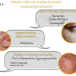 SkinShine - Huidverhelderende Gezichtsserum - 1+1 Gratis!