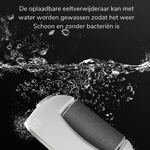 SmoothFoot - Oplaadbare Eeltverwijderaar